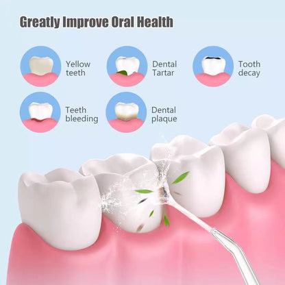 Oral Irrigator